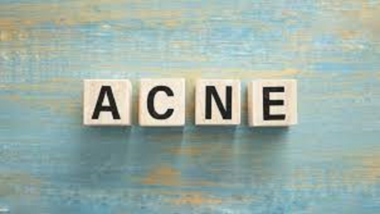 Home Remedies For Acne