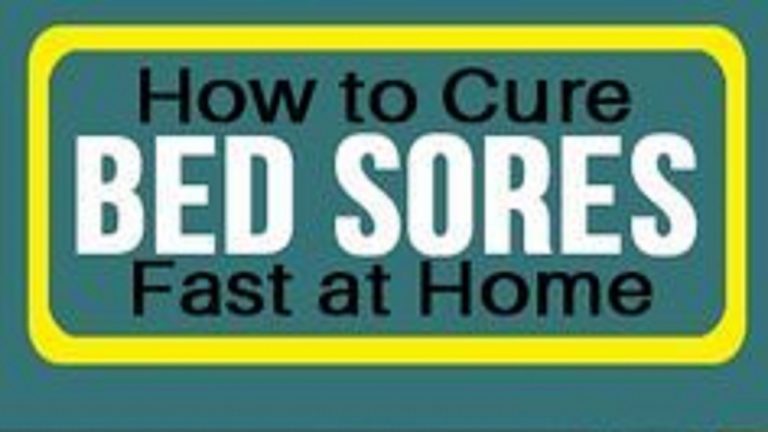 Home Remedies For Bed Sores