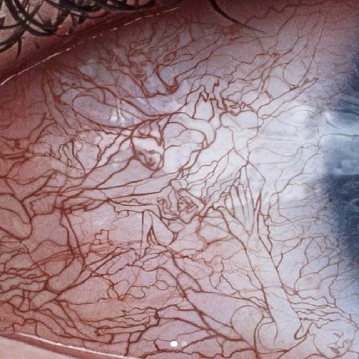 Home Remedies For Bloodshot Eyes