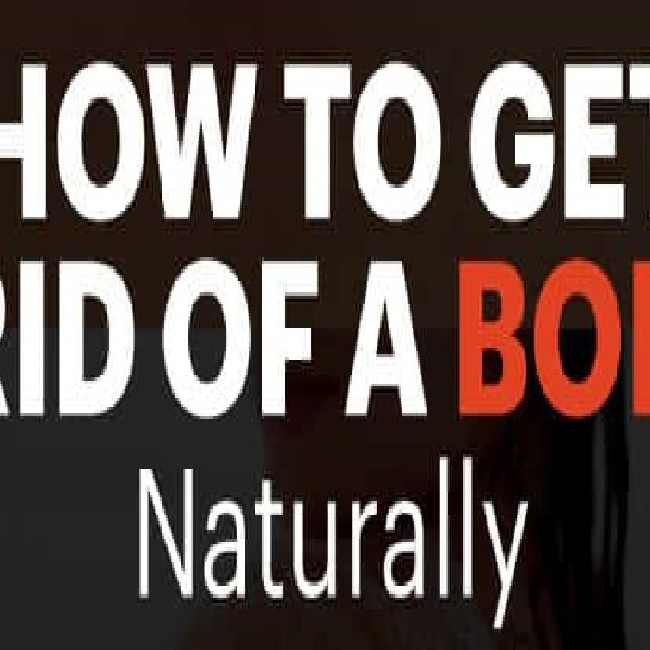 Home Remedies For Boils