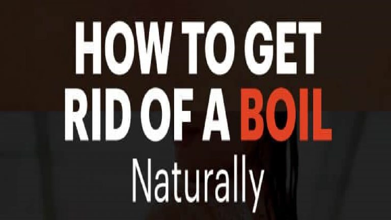 Home Remedies For Boils