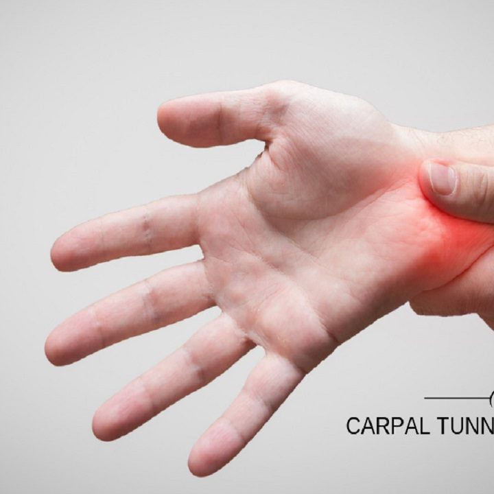 Home Remedies For Carpal Tunnel Syndrome