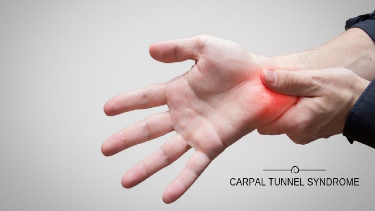 Home Remedies For Carpal Tunnel Syndrome