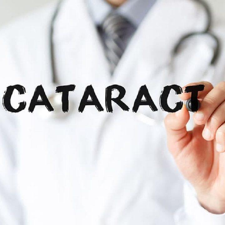 Home Remedies For Cataracts