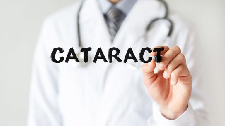 Home Remedies For Cataracts
