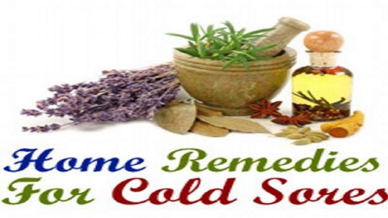 Home Remedies For Cold Sores
