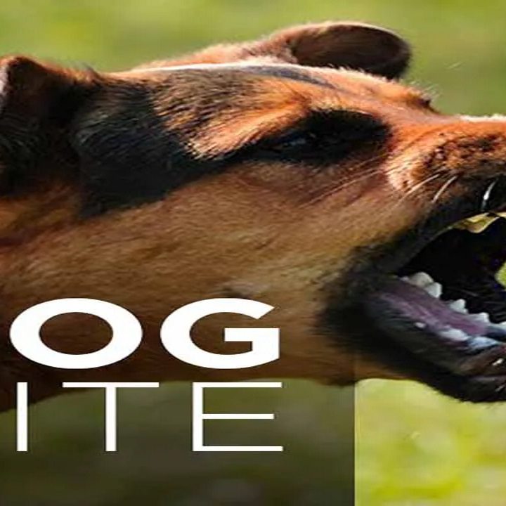 Home Remedies For Dog Bite