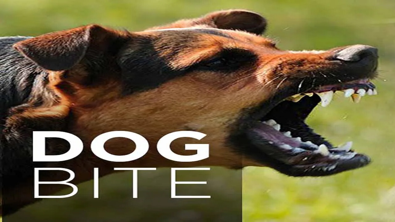 Home Remedies For Dog Bite