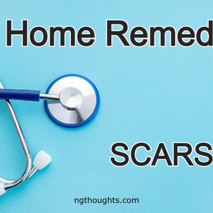 Home Remedies For Scars