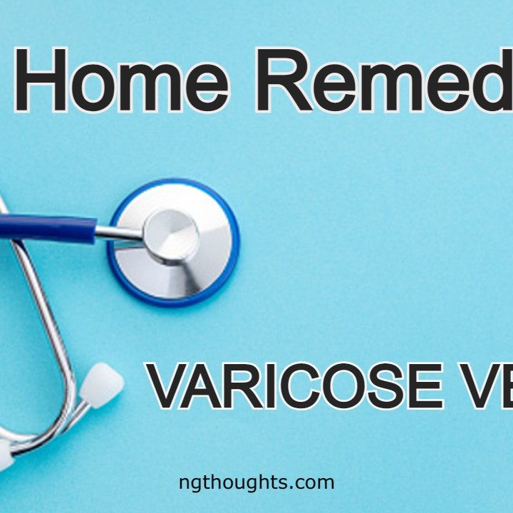 Home Remedies For Varicose Veins