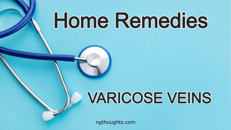 Home Remedies For Varicose Veins