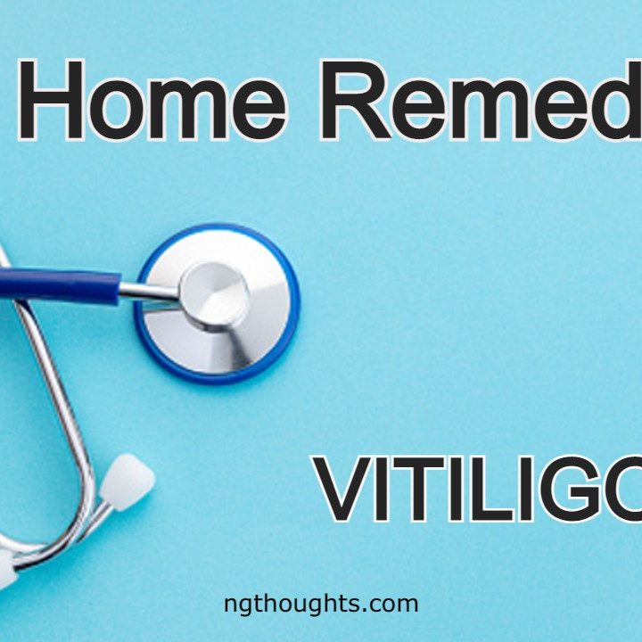 Home Remedies For Vitiligo